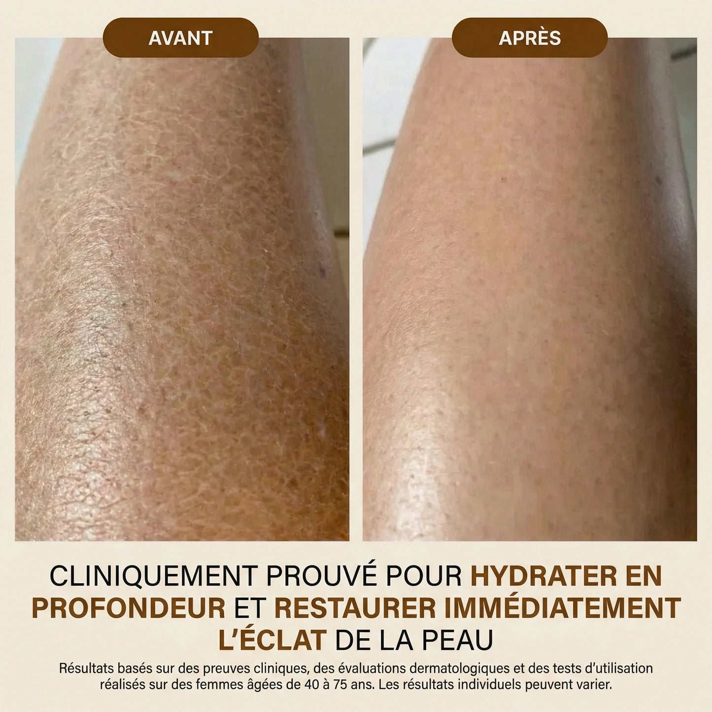 Huile Corps Effet Soyeux – Nutrition & Fermeté