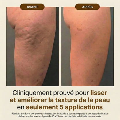 Huile Corps Effet Soyeux – Nutrition & Fermeté