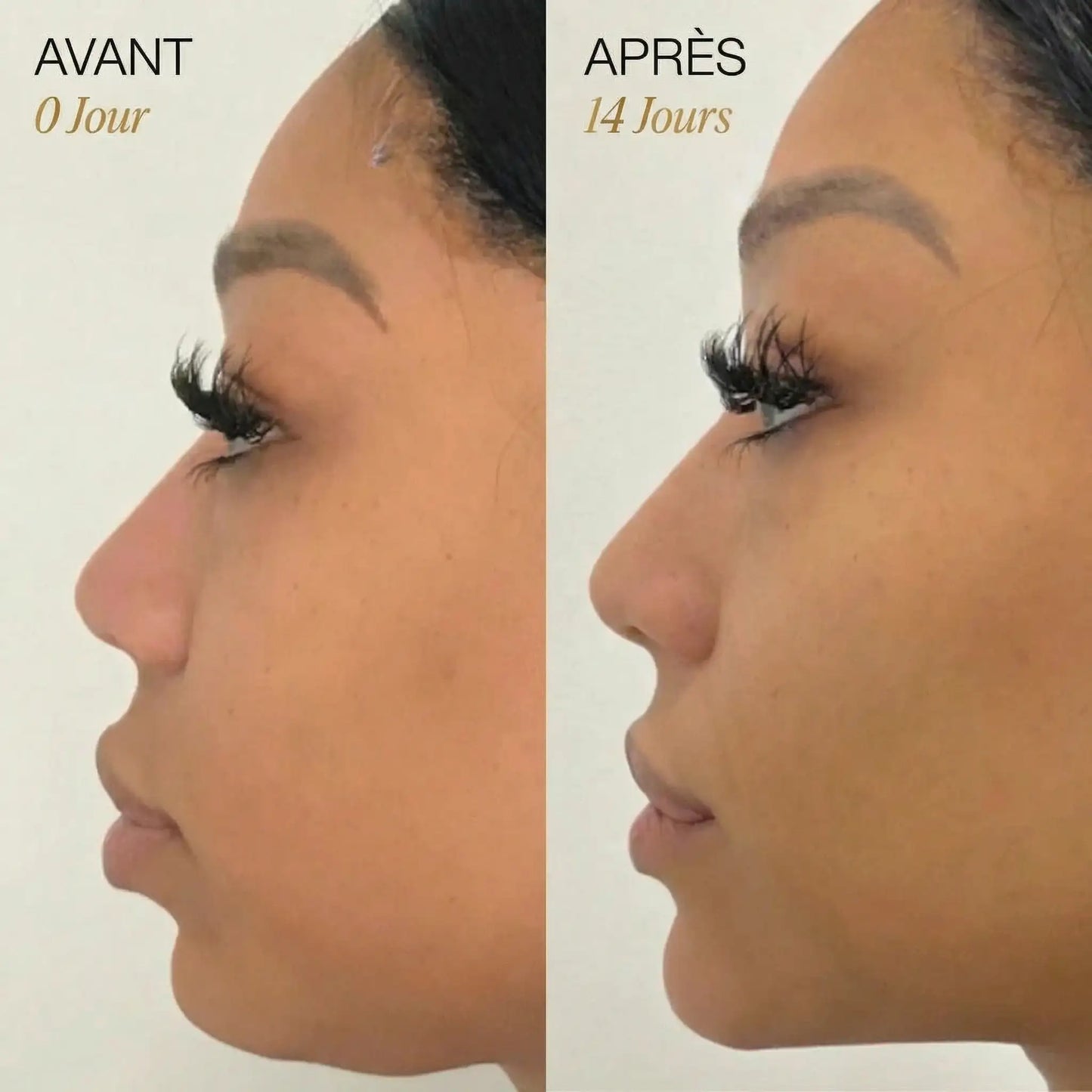 Brosse sculptante visage – drainage lymphatique