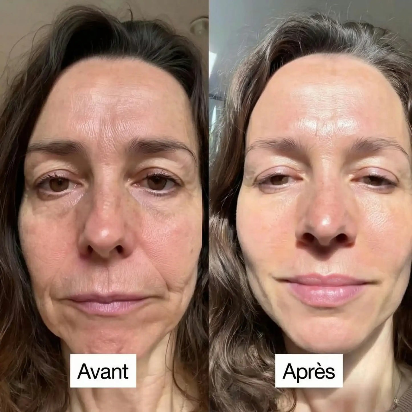 Masque au Bio-Collagène – Effet Peau Lisse & Éclat