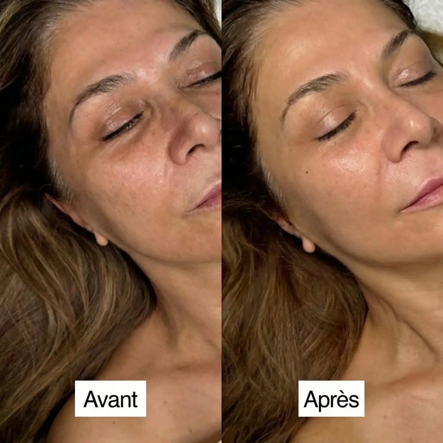 Masque au Bio-Collagène – Effet Peau Lisse & Éclat
