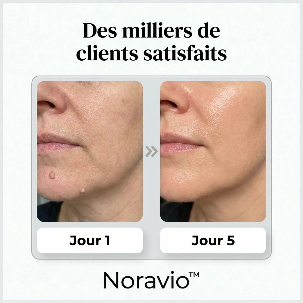 NORAVIO™ – Patch anti-imperfections