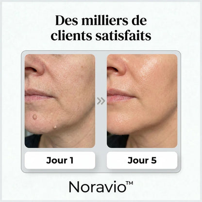 NORAVIO™ – Patch anti-imperfections