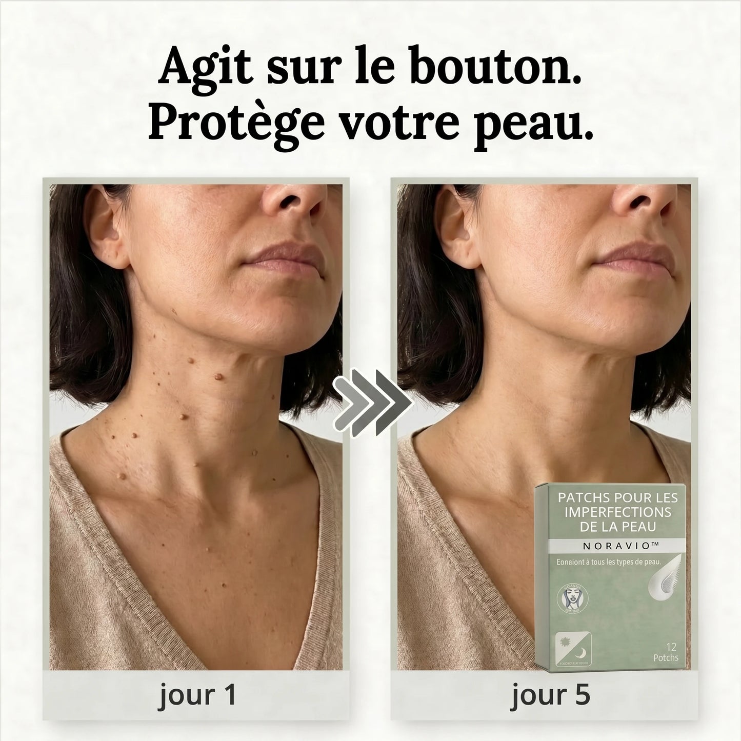 NORAVIO™ – Patch anti-imperfections