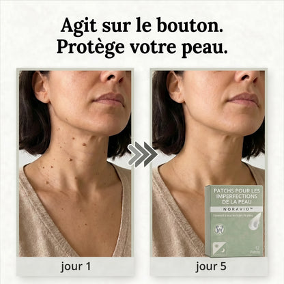 NORAVIO™ – Patch anti-imperfections