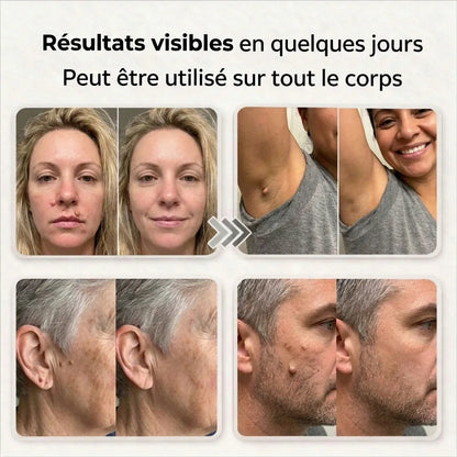 NORAVIO™ – Patch anti-imperfections