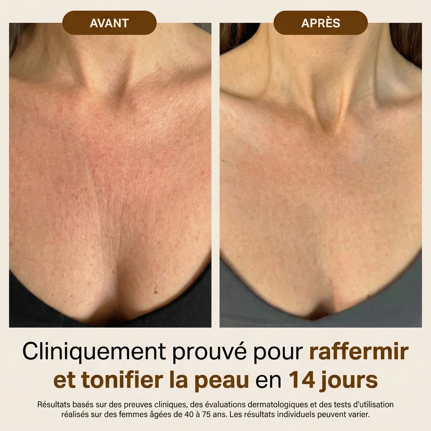 Huile Corps Effet Soyeux – Nutrition & Fermeté
