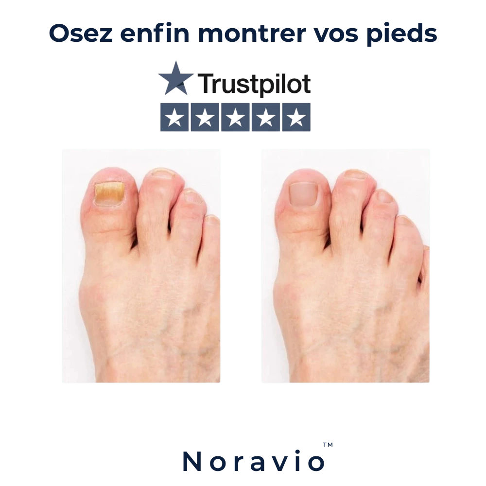 Stylo Ongles Noravio™ | Soin purifiant & réparateur