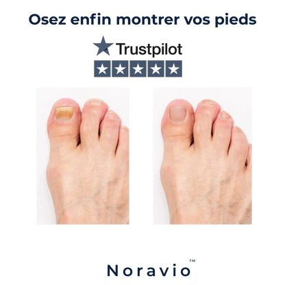 Stylo Ongles Noravio™ | Soin purifiant & réparateur