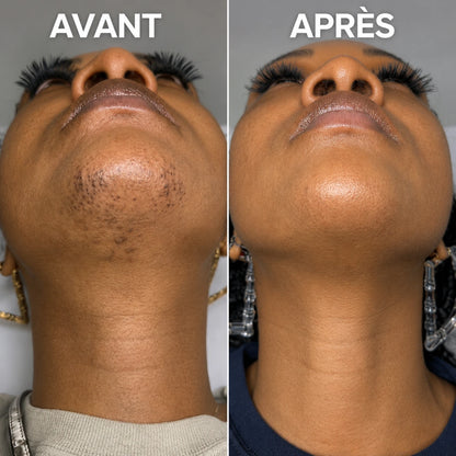 Sérum Anti-Repousse Végétal