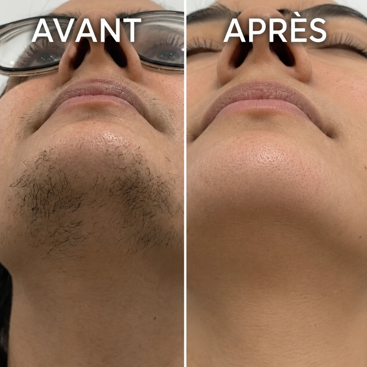 Sérum Anti-Repousse Végétal