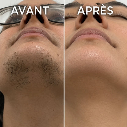 Sérum Anti-Repousse Végétal