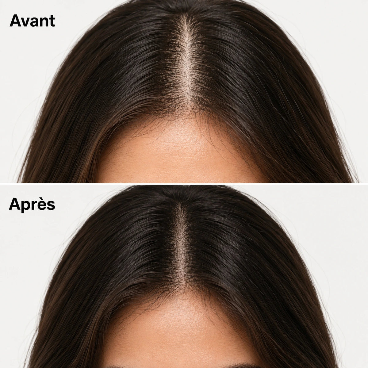 Savon Revitalisant Coréen pour le Cuir Chevelu | Noravio™