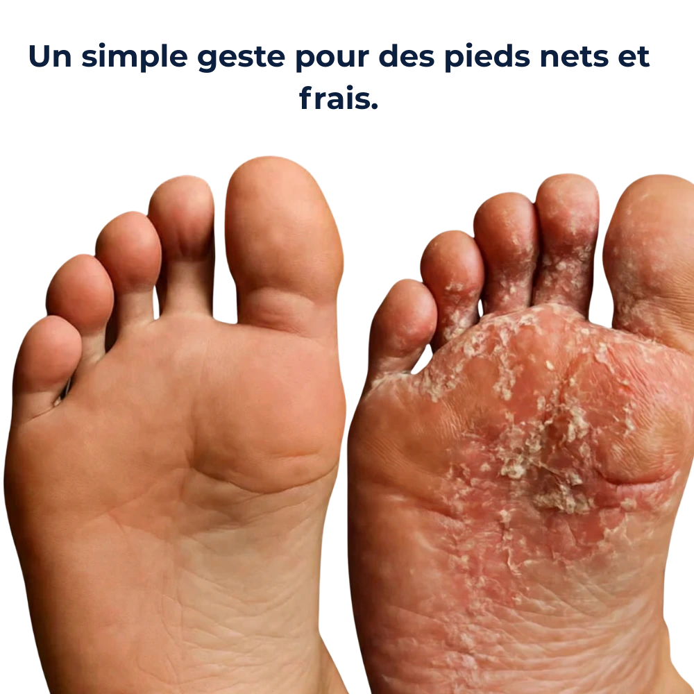 Stylo purifiant ongles & peau