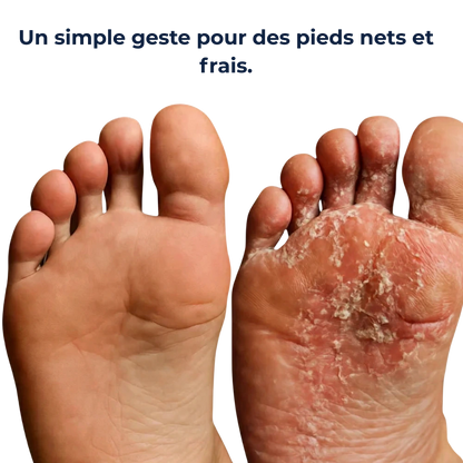 Stylo purifiant ongles & peau